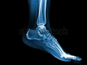 Curso de Radiología de los Miembros Inferiores